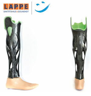 Sanitätshaus Lappe - Orthopädie-Technik - individuelle Unterschenkelprothese